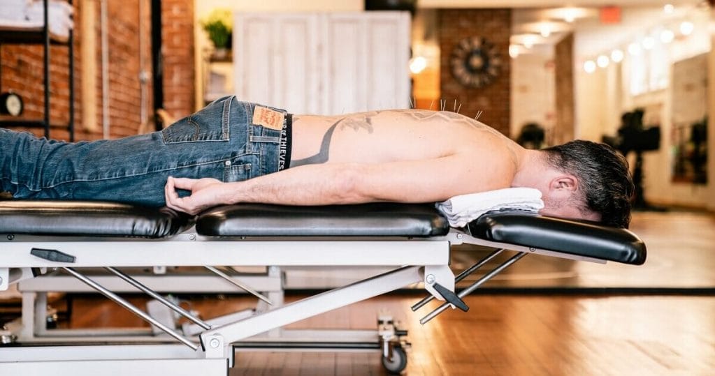 a shirtless man laying down during dry needling treatment for tendonitis pain relief